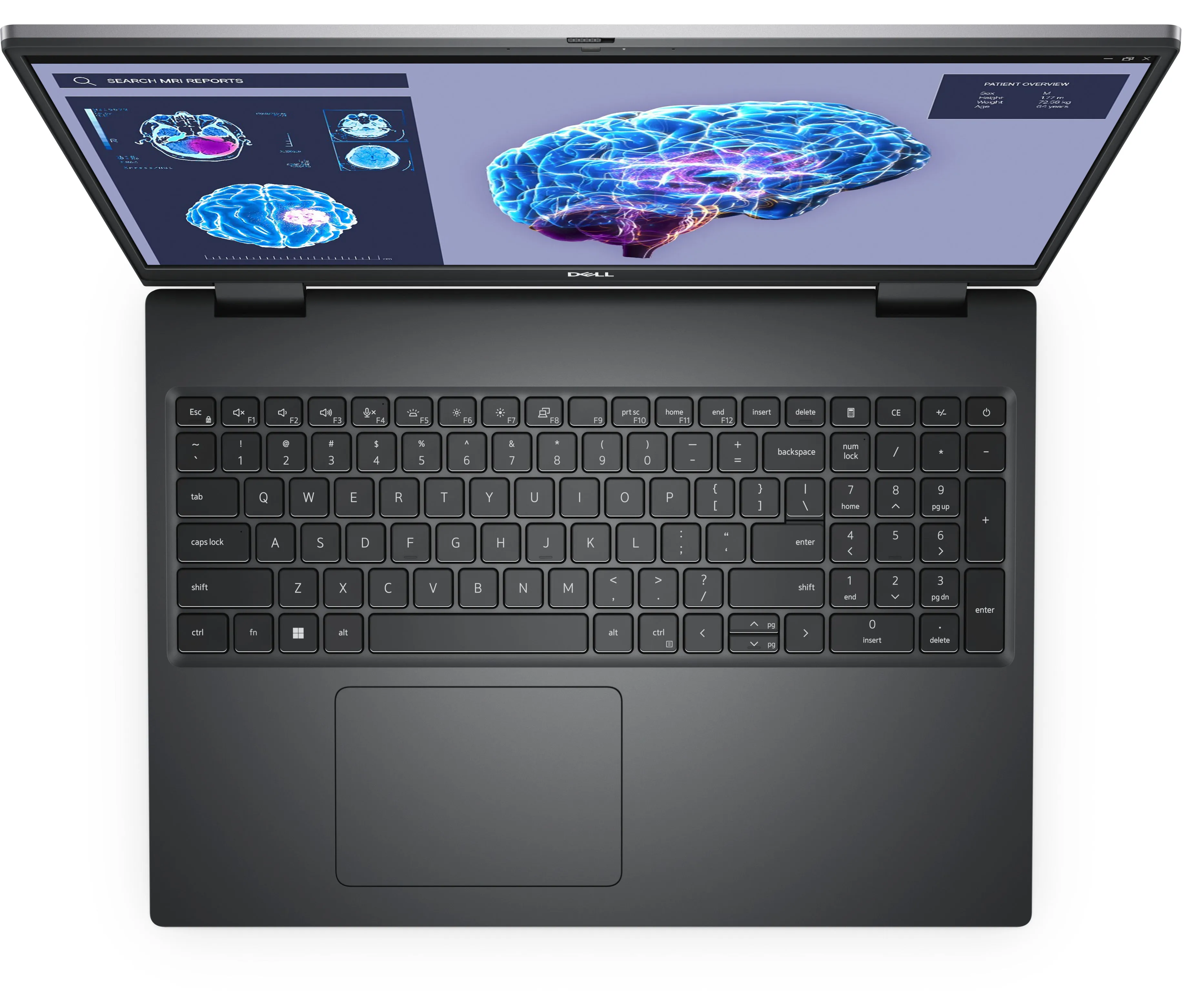 Dell Precision 7680 - Intel Core I7 - 13850Hx / Up To 5.3 Ghz - Win 11 Pro - Nvidia Rtx 2000 Ada - 16 Gb Ram - 512 Gb Ss