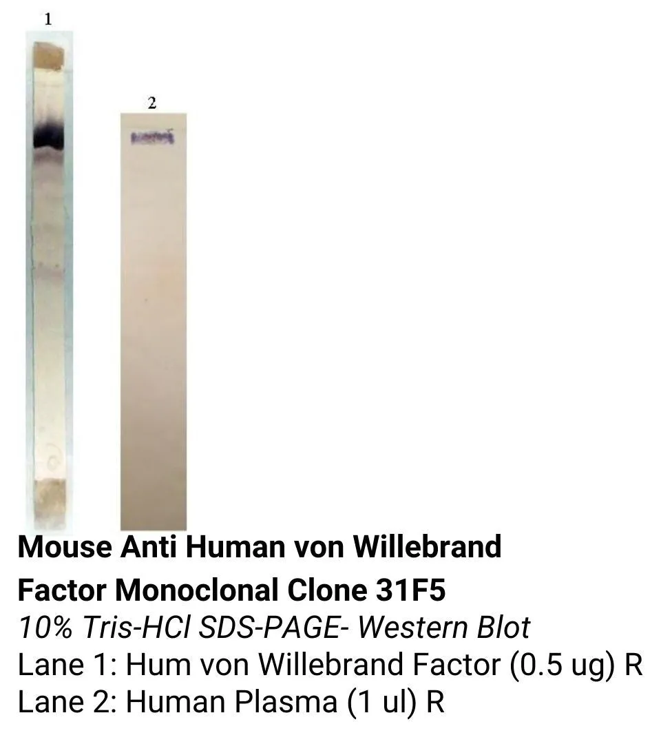 *Mouse Anti Human von Willebrand Factor Monoclonal Clone 31F5